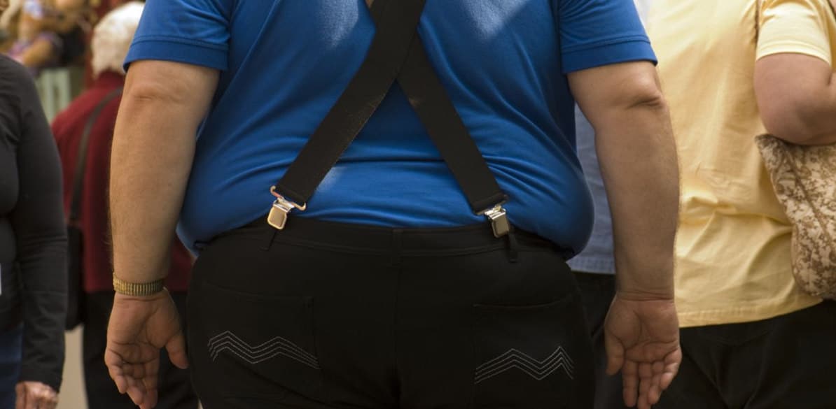La Obesidad influye en la conducción por la posición y por las enfermedades asociadas