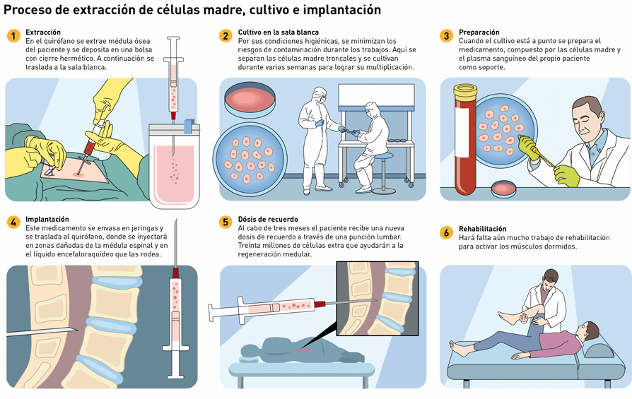 Proceso de extracción de células madre