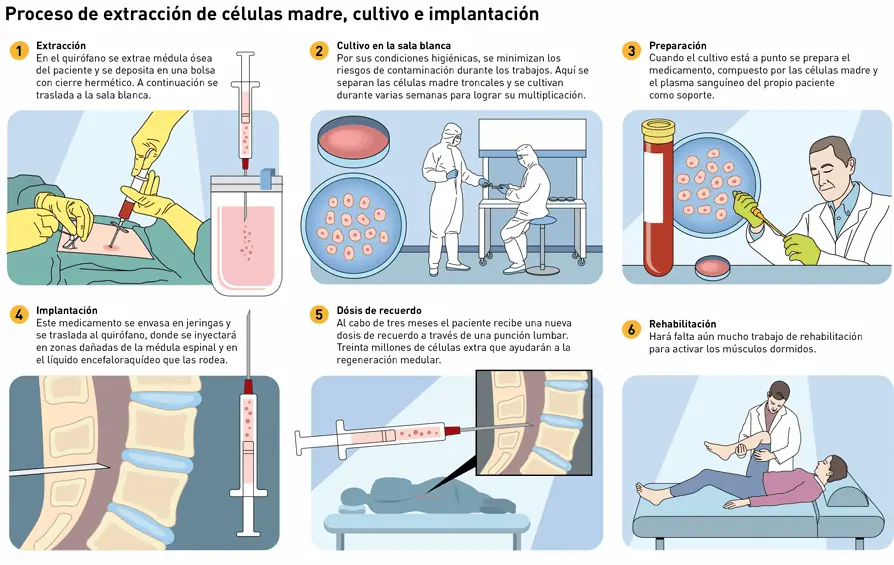 Células madre Proceso de extracción de células madre