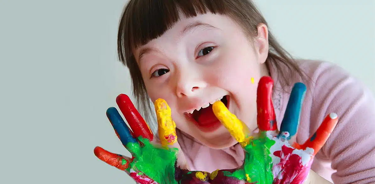 Niños con necesidades especiales Niños con necesidades especiales. Recomendaciones generales al transporte