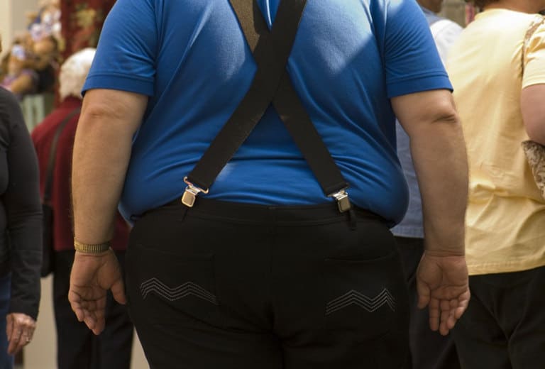 Obesidad mórbida y conducción de vehículos