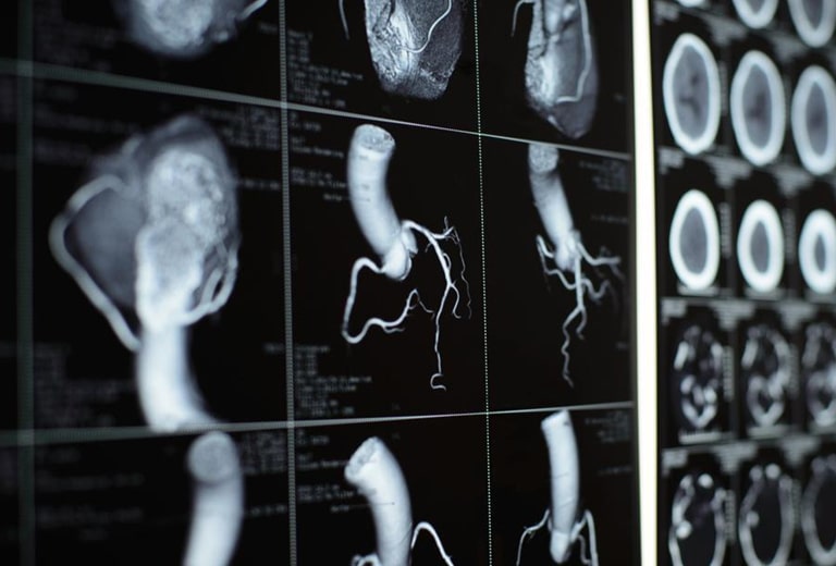 Secondary arterial hypertension of non-renal origin and its influence on driving