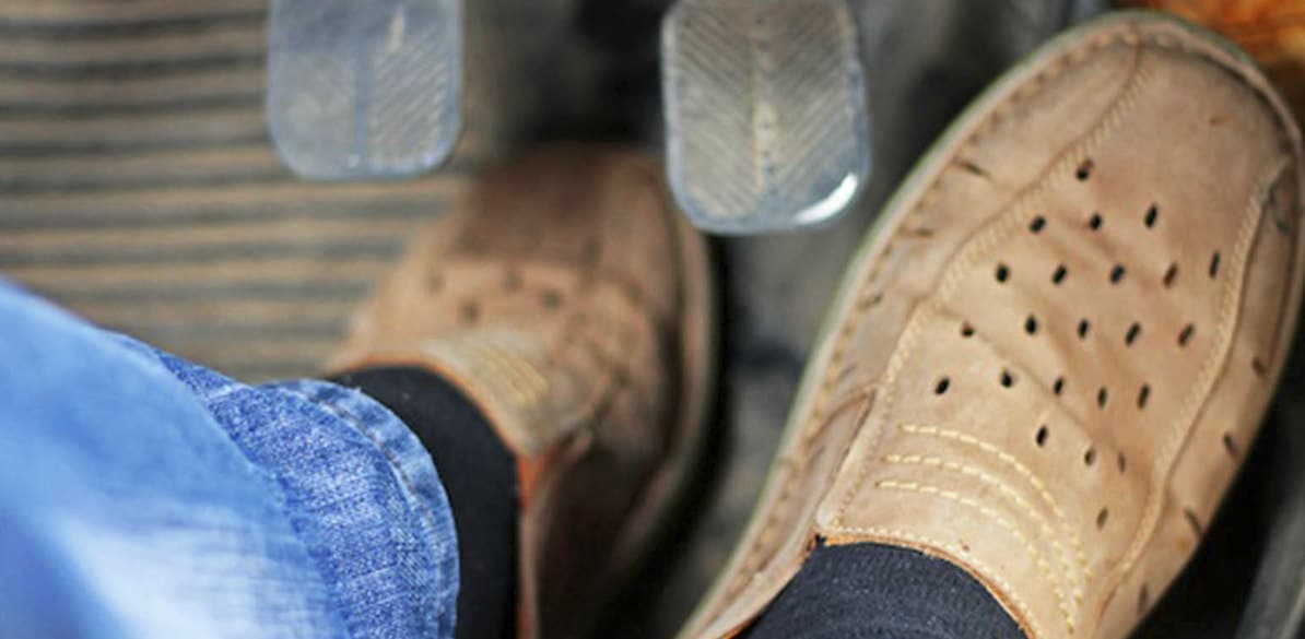 Malformed foot and static disorders of the forefoot interfering with driving Effects of malformed foot and hindfoot on driving