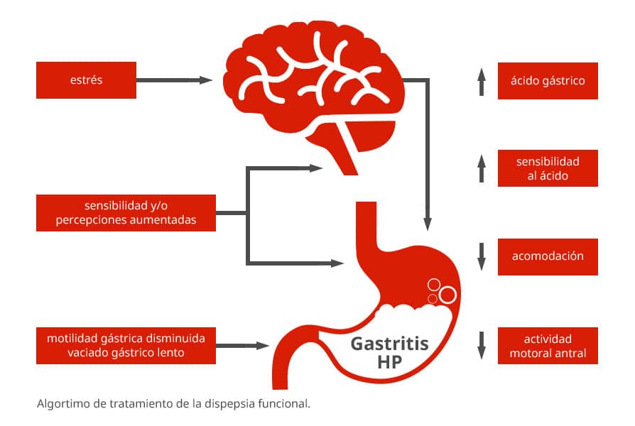 Dispepsia y conducción Algoritmo de tratamiento de la dispepsia funcional