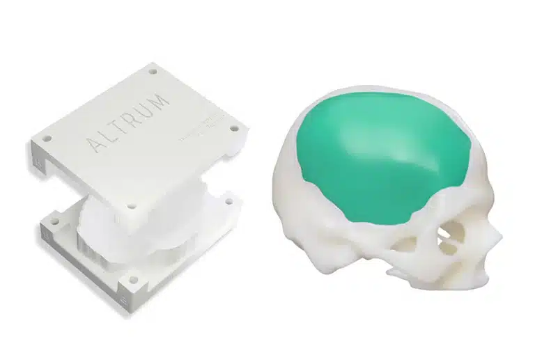Altrum Altrum, un desarrollador de prótesis craneales con impresoras 3D