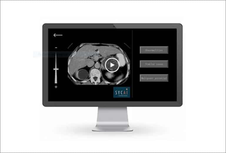 Software basado en inteligencia artificial para interpretar la medicina abdominal de pruebas de imagen