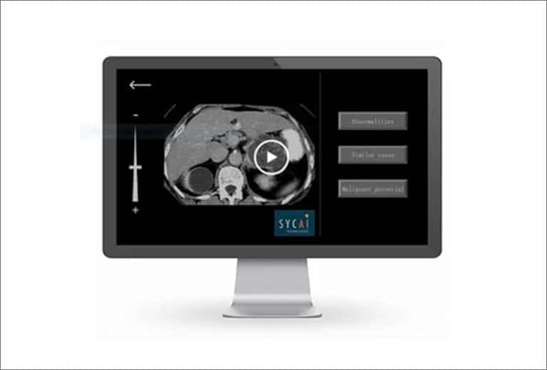 Sycai Technologies SL Software basado en inteligencia artificial para interpretar la medicina abdominal de pruebas de imagen
